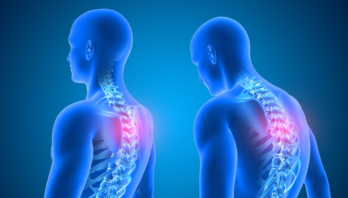 Body diagram of hurt back and joints