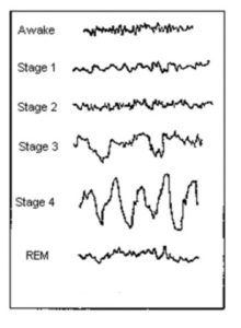 Brain Waves During Sleep
